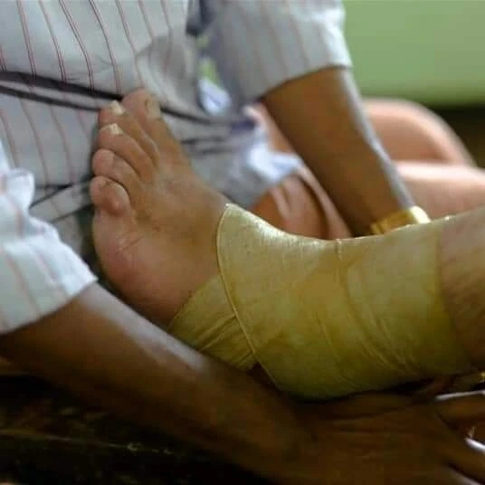 Traditional foot treatment and bandaging